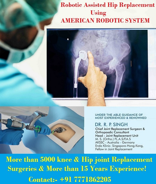 Joint Replacement Surgery- A Brief Introduction for You
